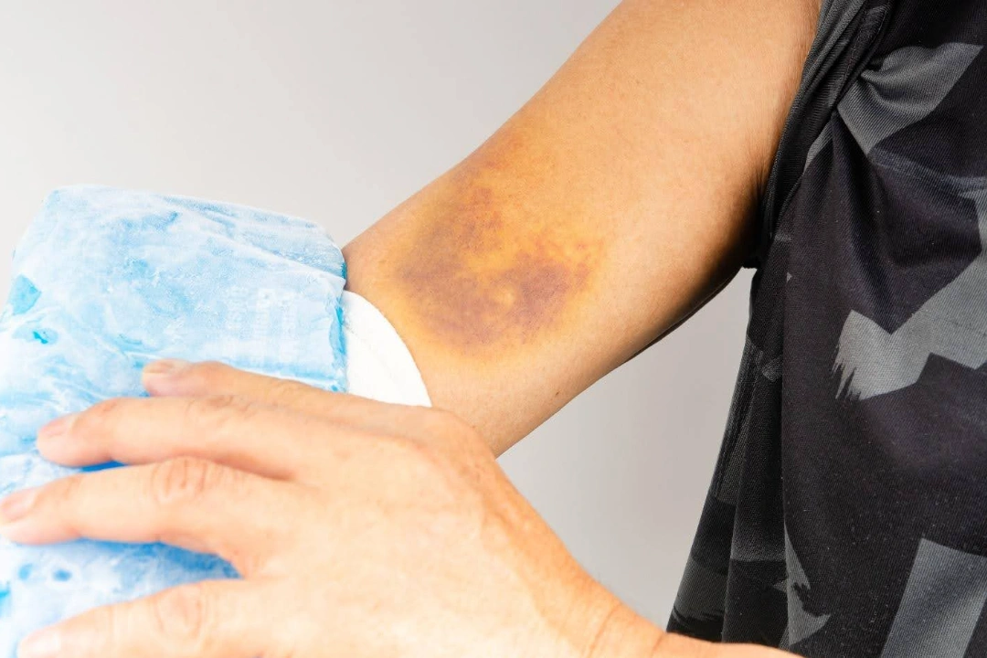 Elbow dislocation symptoms Singapore.