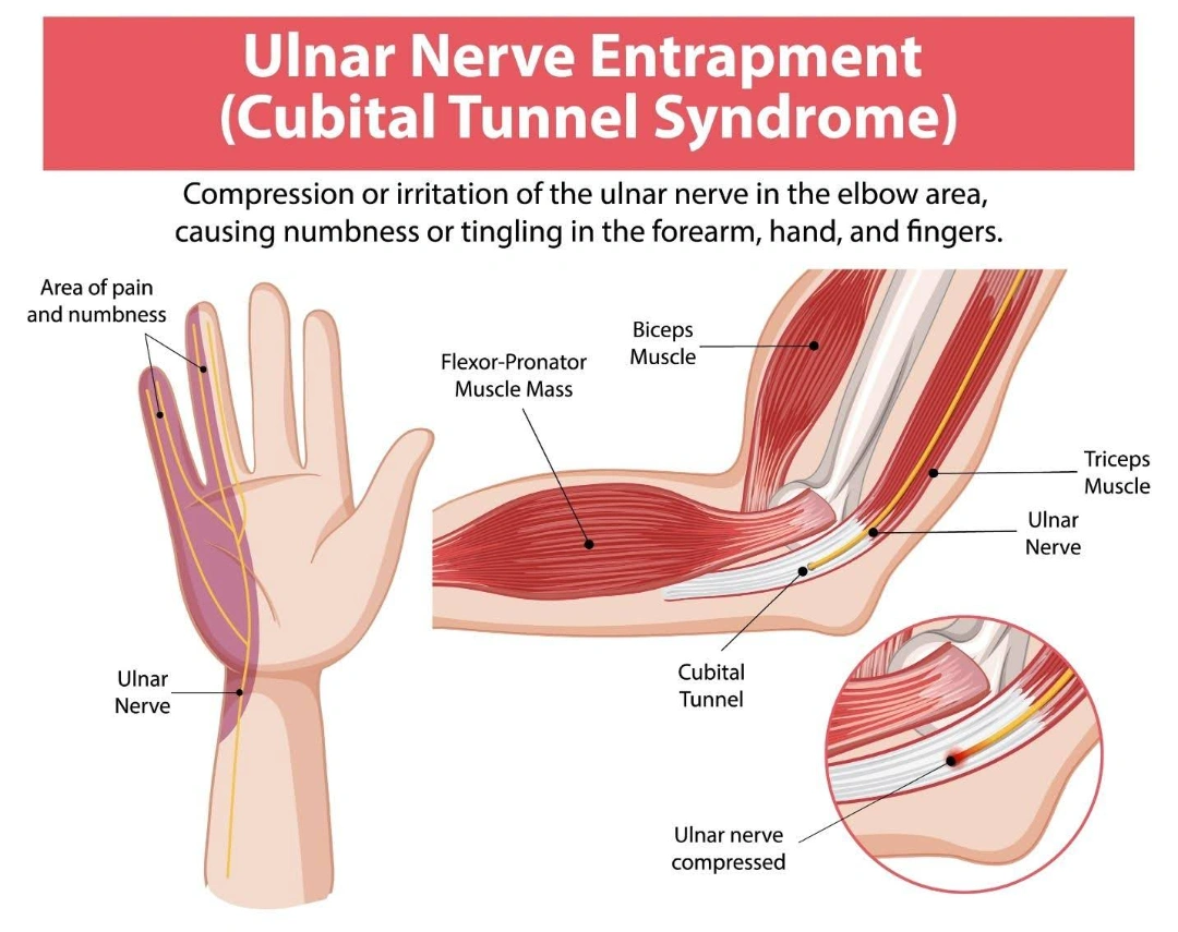 treatment for elbow pain.