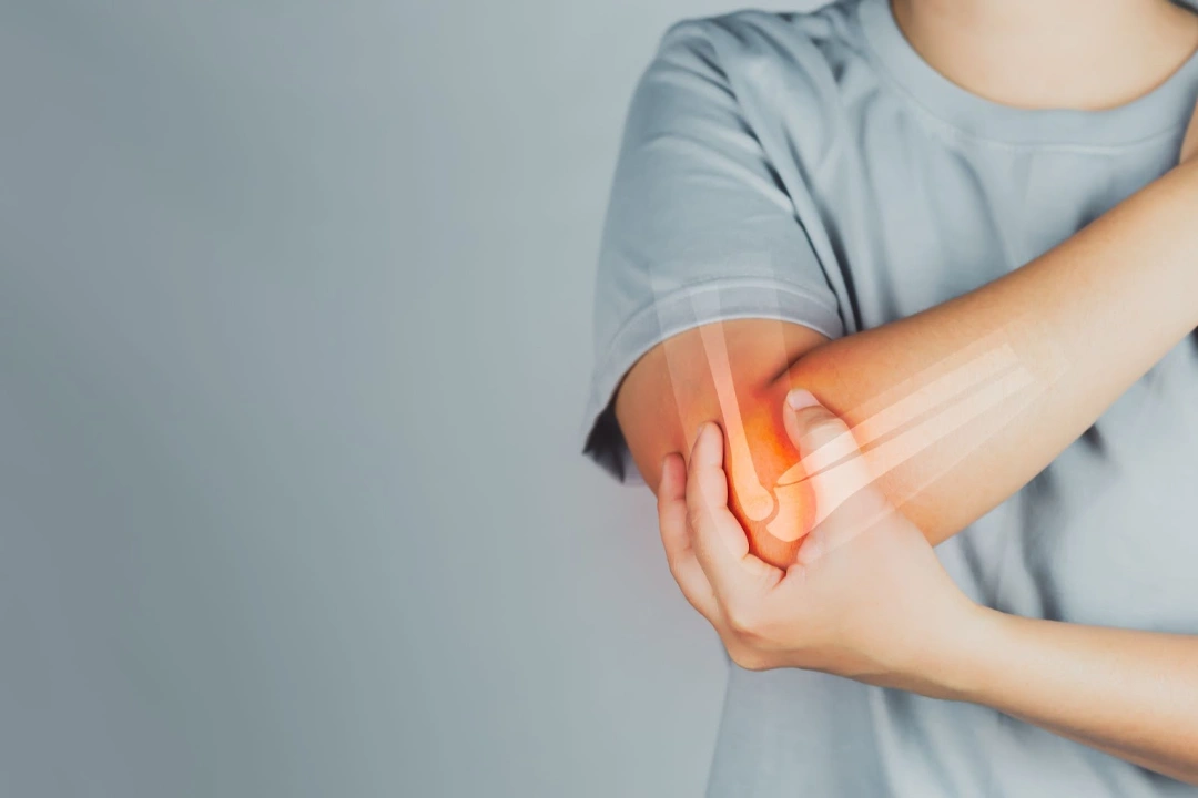 Symptoms of Elbow Fracture Singapore
