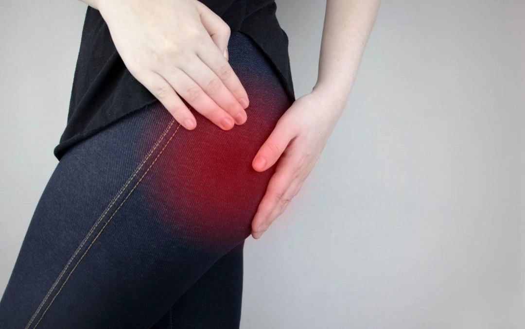 Symptoms of Piriformis Syndrome Singapore